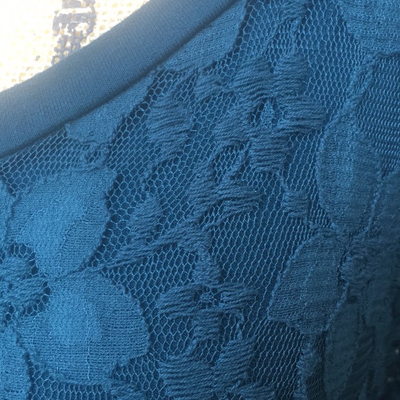 Adrianna Papell Lace - Picture 3 of 9